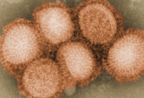 swine-flu-virus-cells.jpg